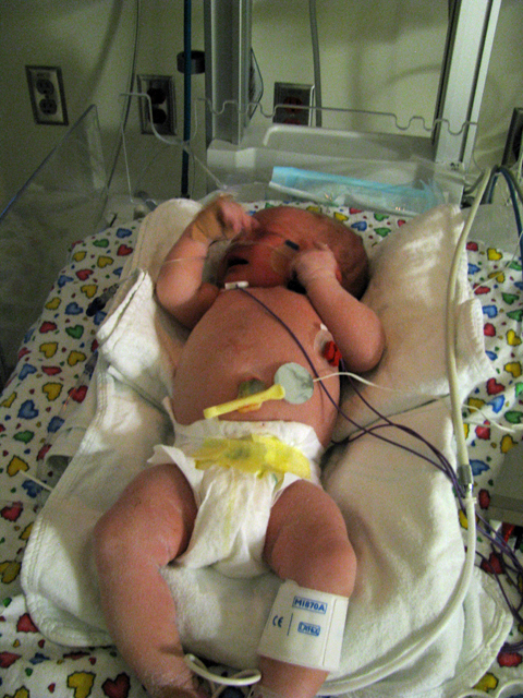 Sara Emily in NICU